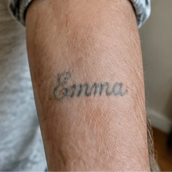 Name → phoenix · forearm — Original