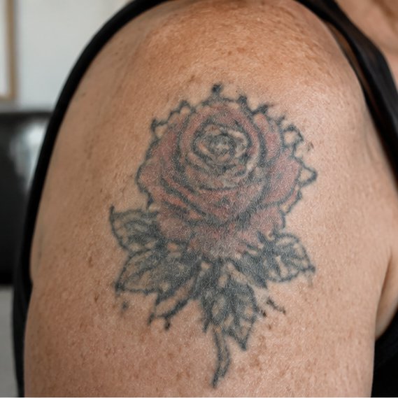 Old rose → dagger & snake · shoulder — Original