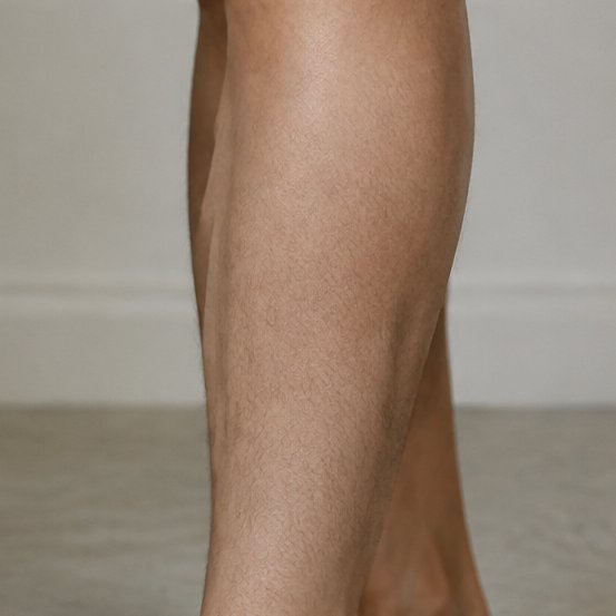 Fine-line moth · upper arm — Original