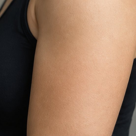 Micro-realism · shoulder — Original